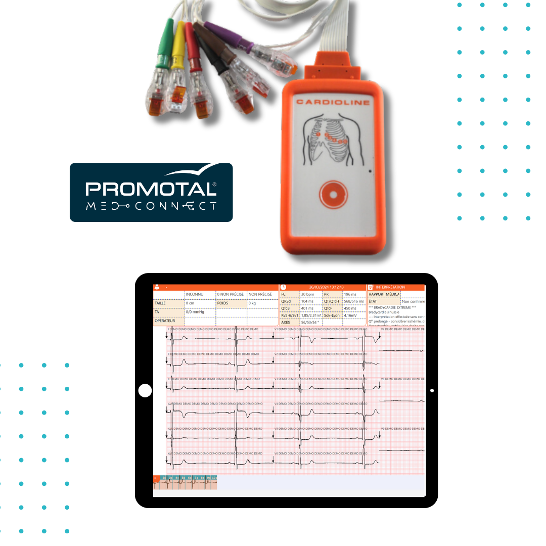 ECG Conectado de 12 Derivações Promotal MedConnect
