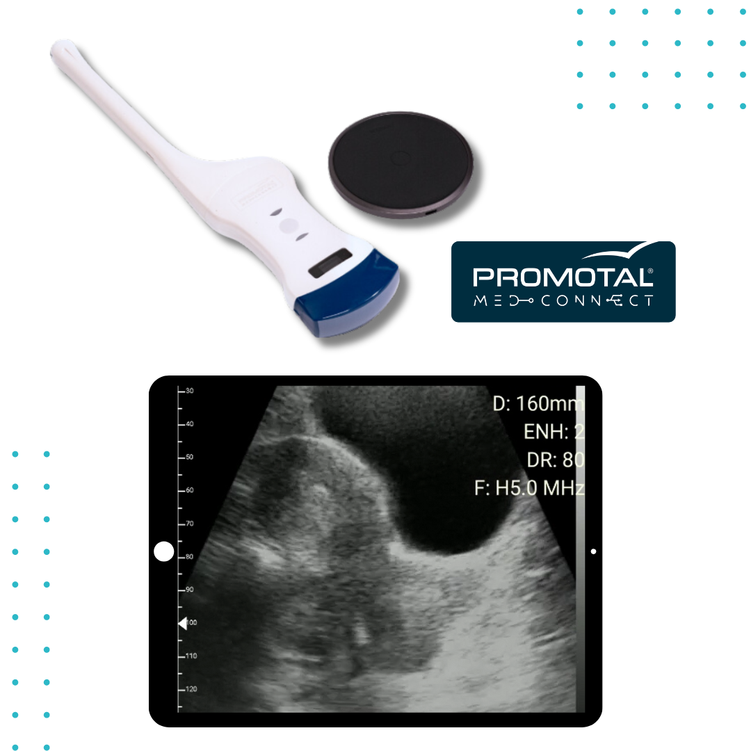 Ecógrafo Ultra Portátil Ginecología Promotal MedConnect