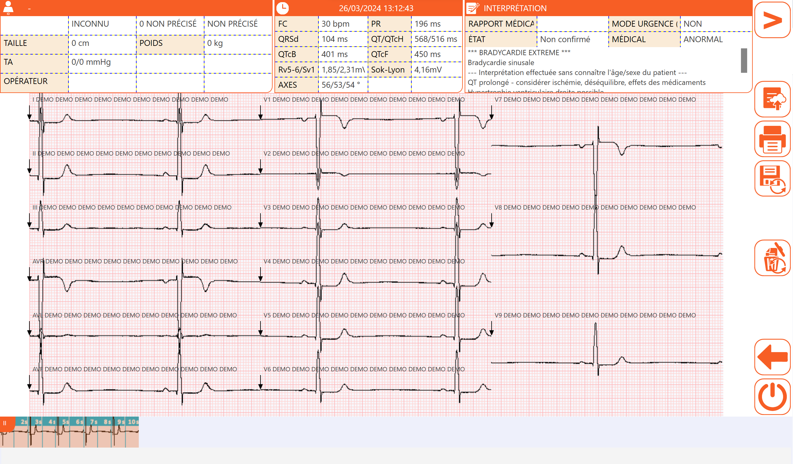 ECG Conectado de 12 Derivações