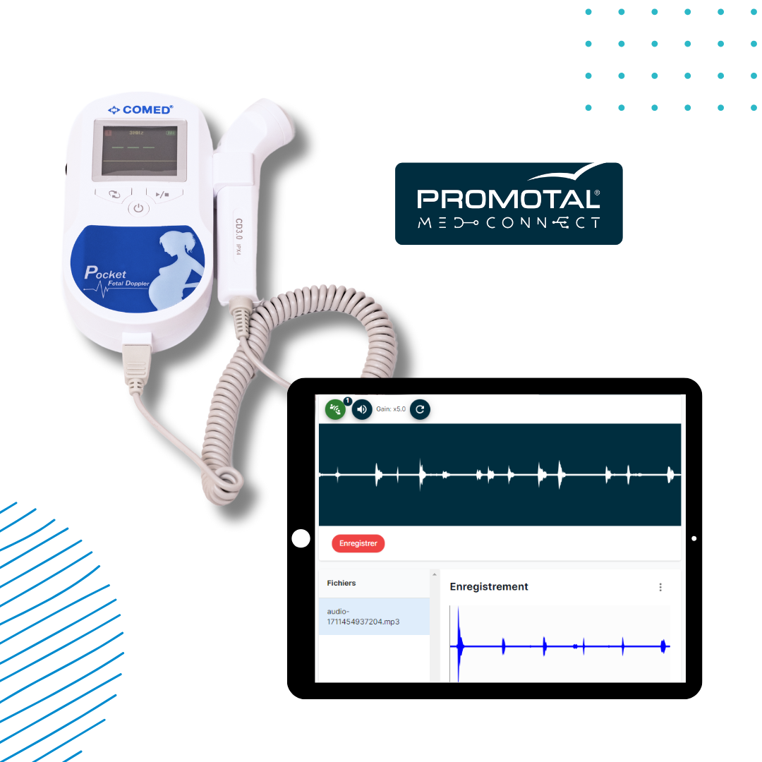 Doppler Fetal Conectado Promotal MedConnect