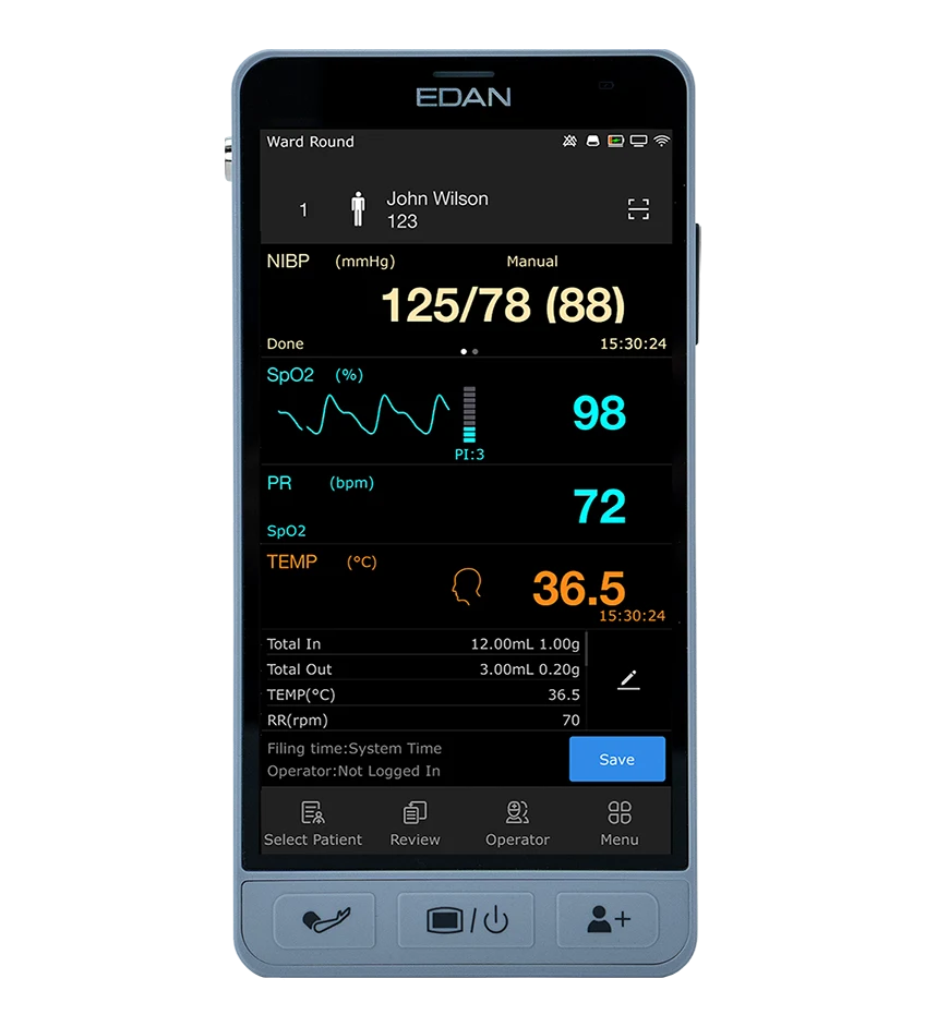 Edan iM3s Handheld Vital Signs Monitor